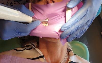 Caso de éxito. Endodoncia realizada por Miriam