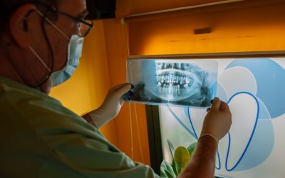 Trismus dental. ¿Qué causa este problema?