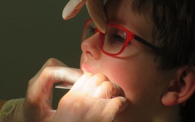 Dientes de tiburón. ¿Qué son y cuál es el tratamiento más adecuado?