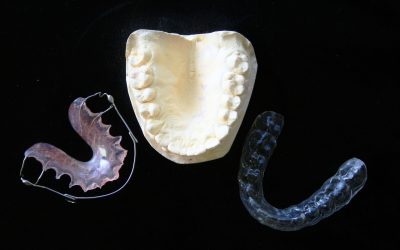 10 curiosidades sobre la odontología